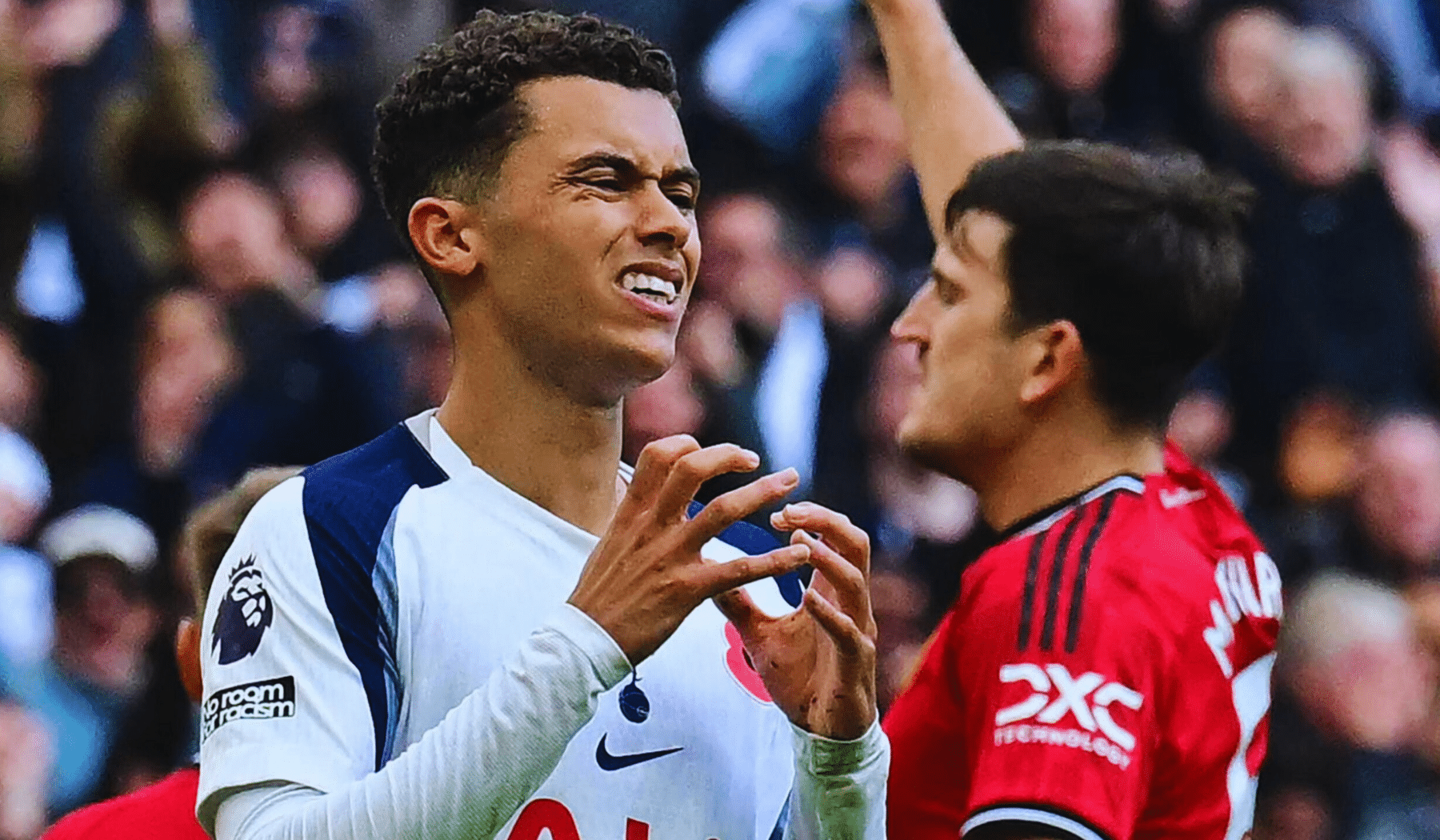 Man Utd Draw Spurs: Sesko Knee Injury Fears